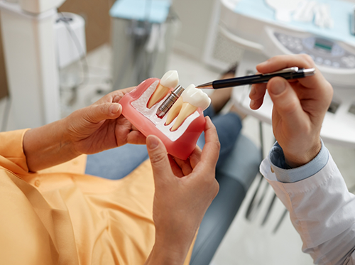 Dentist showing patient model of dental implant in Delray Beach