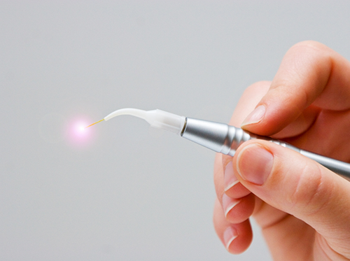 Hand holding a soft tissue dental laser