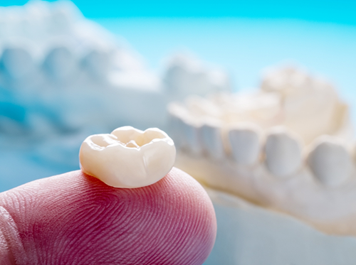 Dental crown resting on a finger